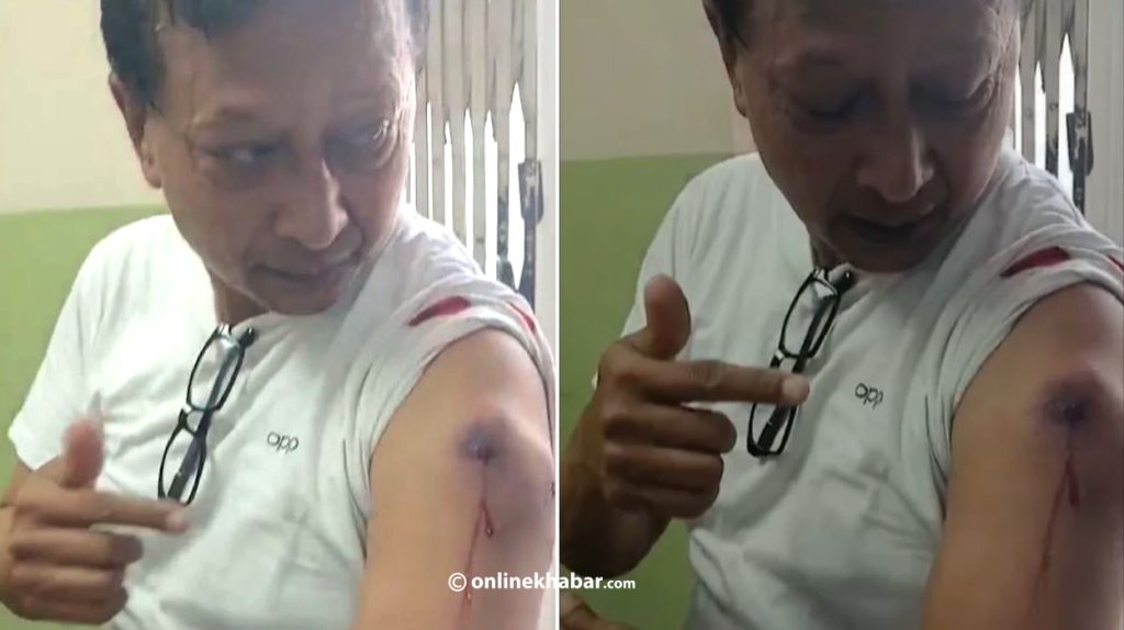 Ensure personal and professional safety of frontline media persons: Journalist Shyam Shrestha