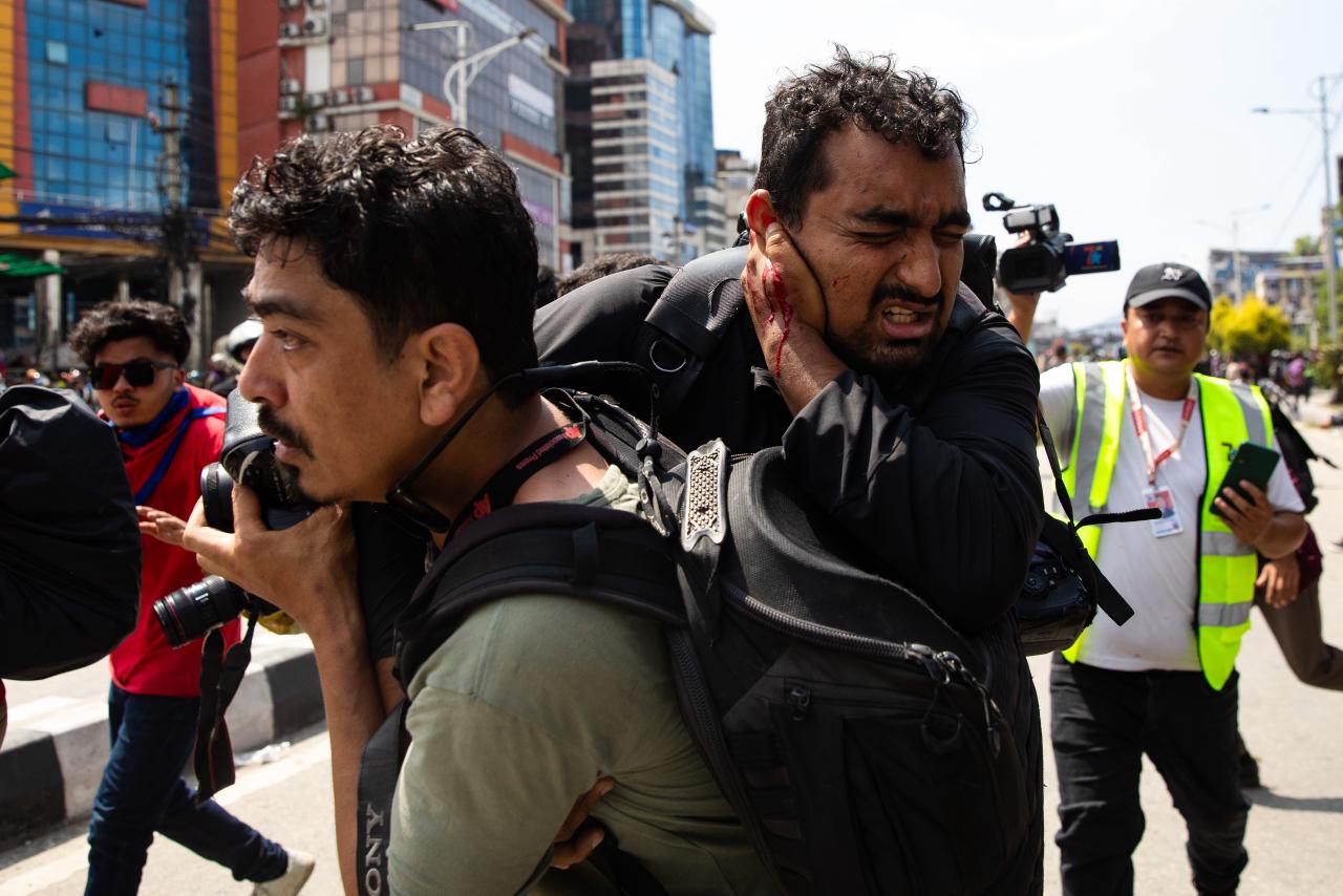 Lack of skills, safety tools threaten reporters covering protest: Injured journalist Dhungana